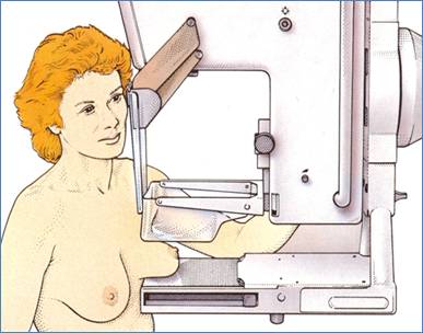 Как выполняется маммография