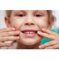 Травма зуба у ребенка: разновидности