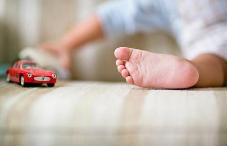 Степени плоскостопия у детей Степени плоскостопия у детей